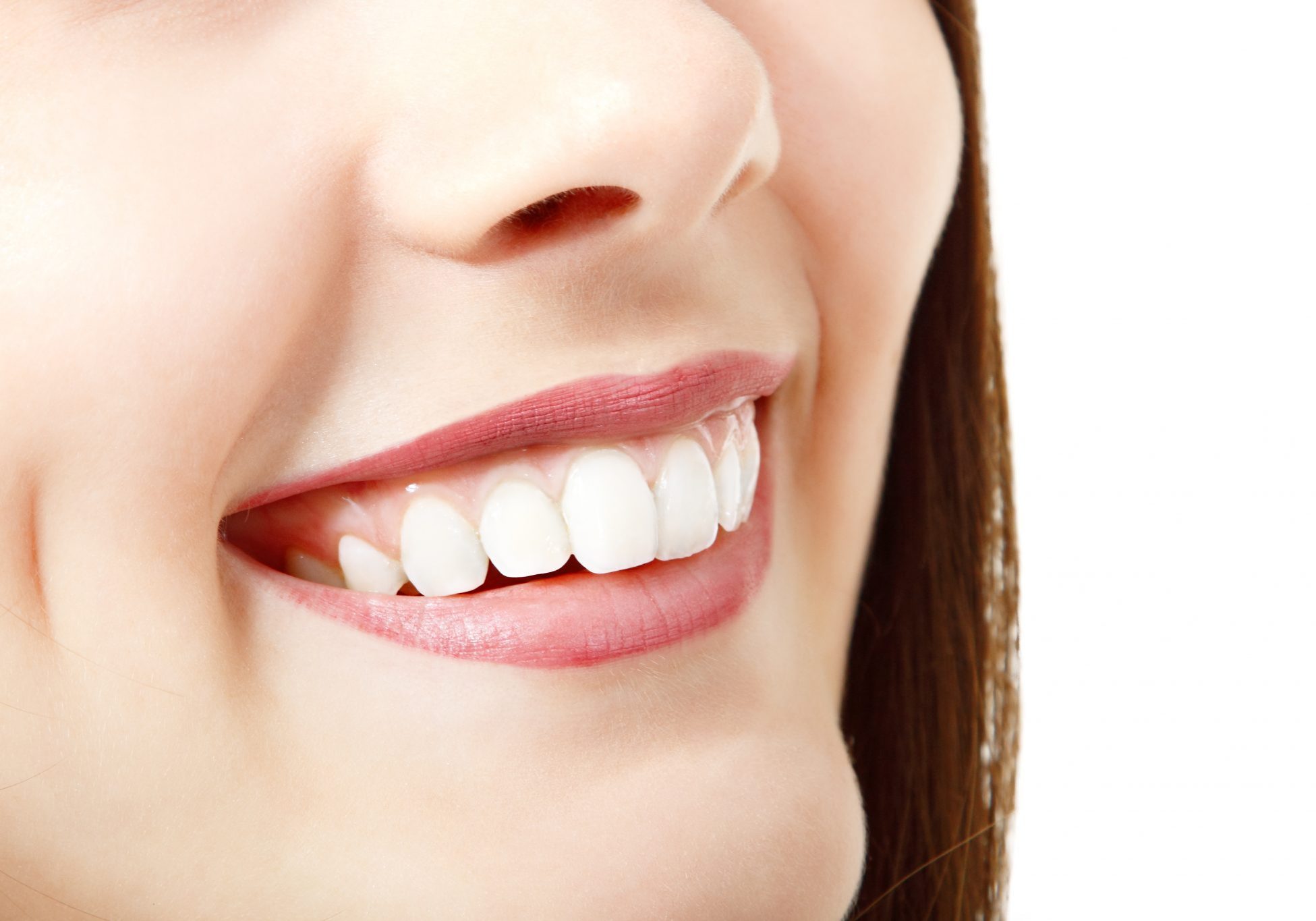 Tratamiento para corregir sonrisa gingival Corregir Sonrisa Gingival